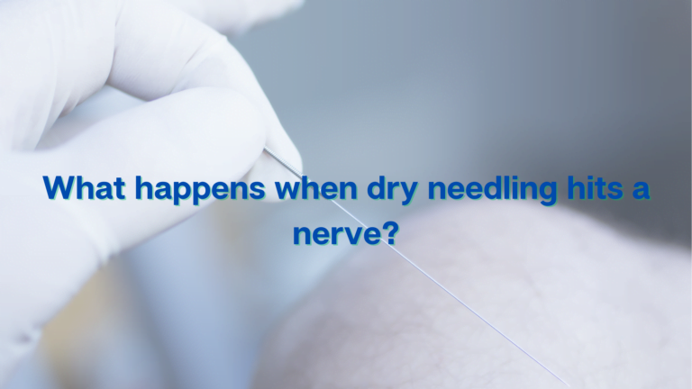 What happens when dry needling hits a nerve?